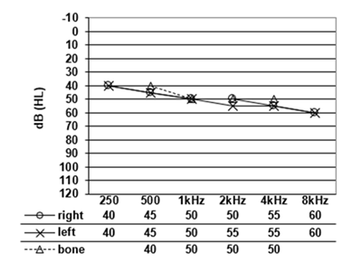 audiogram 2026